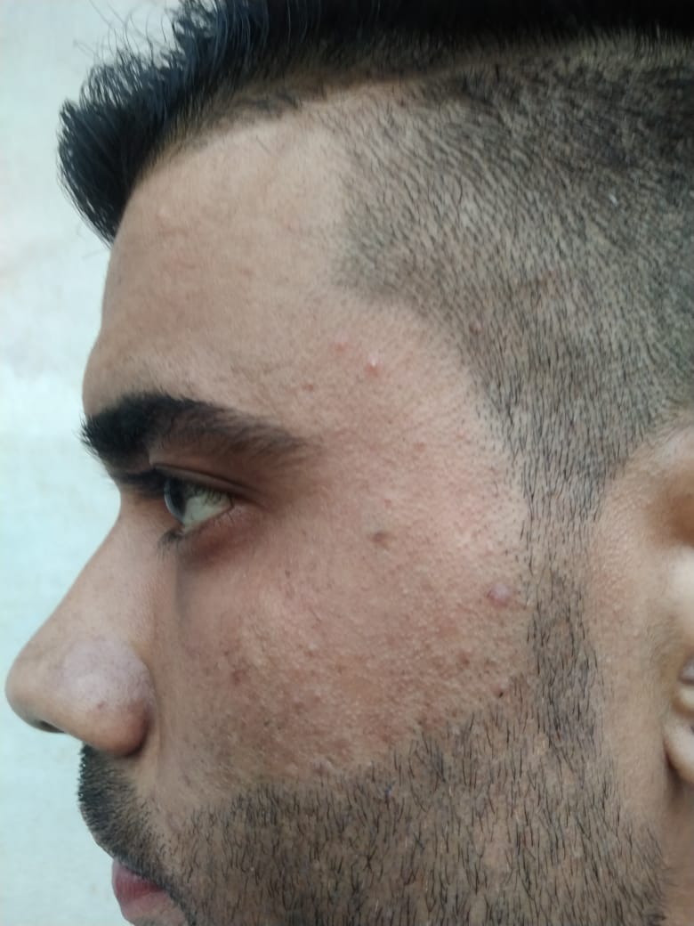 After