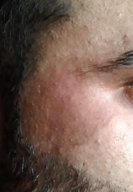 Before